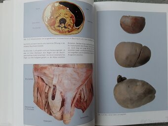 Výstavní katalog KÖRPERWELTEN-Prof.G.HAGENS - 7