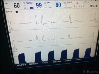 Profi defibrilátor/monitor Corpuls 3 - 7