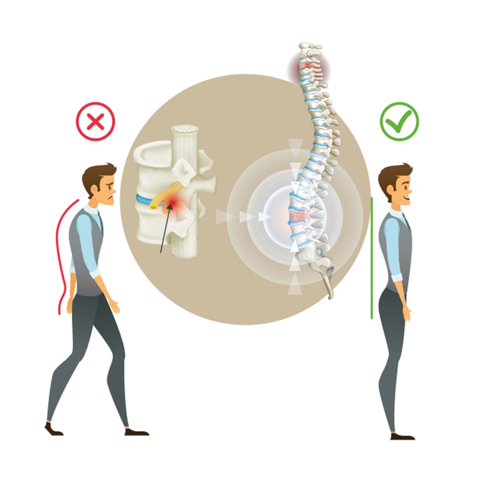 KETTLER - APOLLO - 9